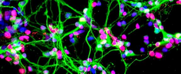 Neurons growing in a culture dish (NASA)