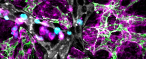 A microscopic image shows lab grown bone marrow and blood vessels highlighted in gray and green weaving through a network of supportive cells and proteins highlighted in magenta.